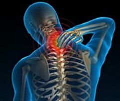 osteochondroza odcinka szyjnego kręgosłupa