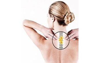 osteochondroza szyjna u kobiety