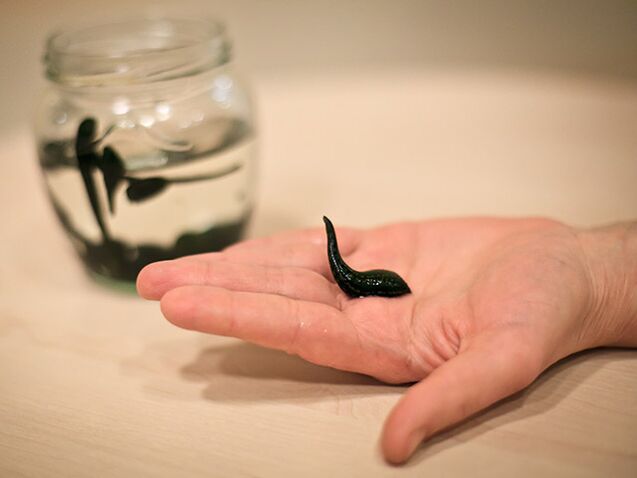 zastosowanie w leczeniu artrozy stawu kolanowego